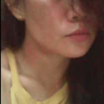 Yna