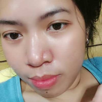eyna