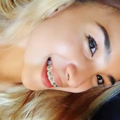 melynlasconia