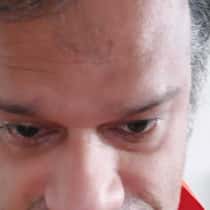 Anas
