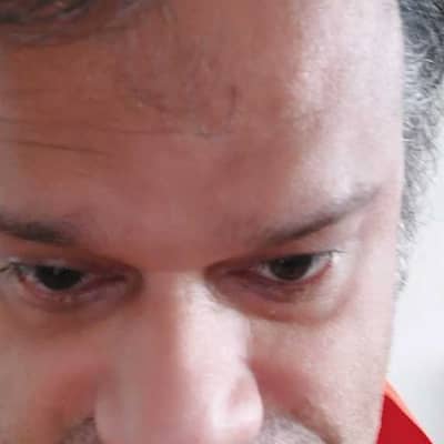 Anas